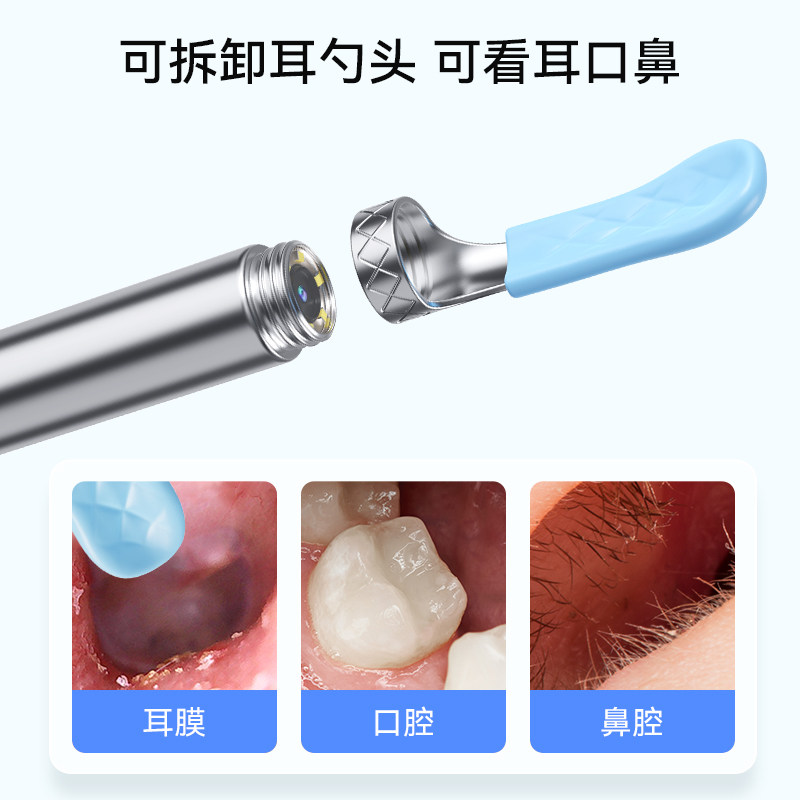 Sunuo Intelligent Visual Ear Cleaning Tool - Image 2